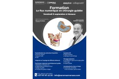 Formation exoplan & coDiagnostiX - Le flux numérique en chirurgie guidée